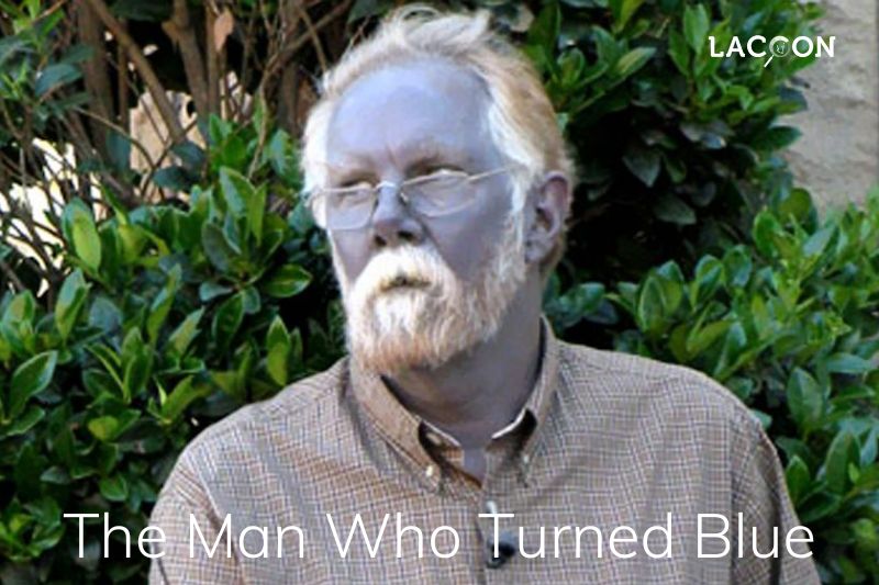 Shocking Condition The Man Who Turned Blue - Effect of Dietary Supplements Full Detailed 2023